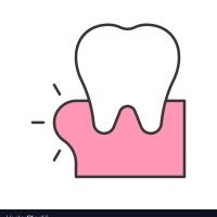 Gingivitis