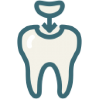 Dental Fillings