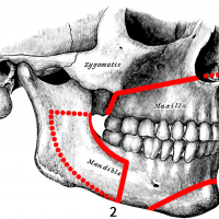 Orthognathic Surgery